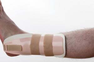 How an Orthopaedic Surgeon Can Help You With Foot Fractures