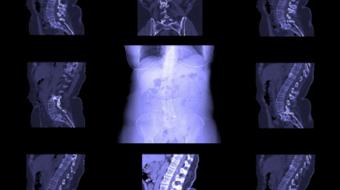 What Can MRI Reveal About the Back Pain ?