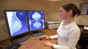 breasts mammography images