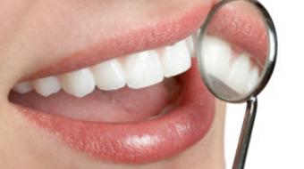 dental white teeth
