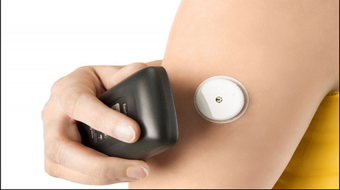 New Advances in Blood Glucose Monitoring - FLASH Technology