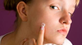 Dr. Jan Dank, MD, discusses teenage acne medications and creams.