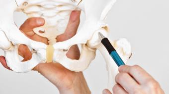 Hip Replacement: Materials for Hip Ball and Socket Surgery