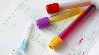 Prenatal Blood Tests