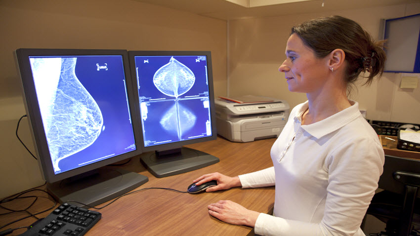 breasts mammography images