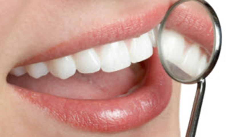 dental white teeth